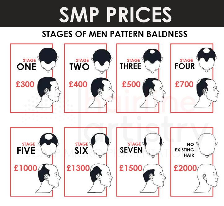 cost of scalp micropigmentation bristol portishead north somerset smp price price of smp men pattern baldness