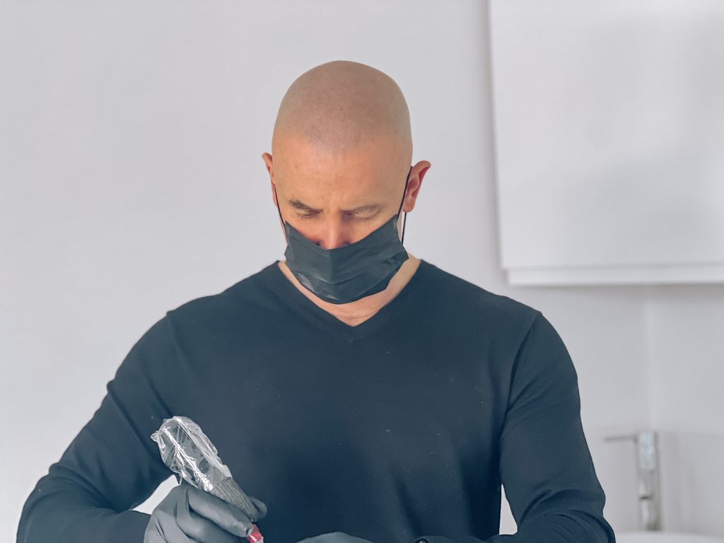 scalp micropgimentation bristol portishead hairline restoration baldness smp treatment near birstol